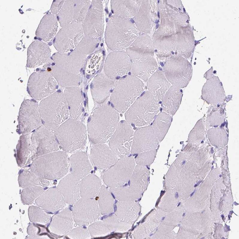 MMP-9 Antibody - BSA Free Immunohistochemistry-Paraffin: MMP-9 Antibody - BSA Free [NBP1-85575]