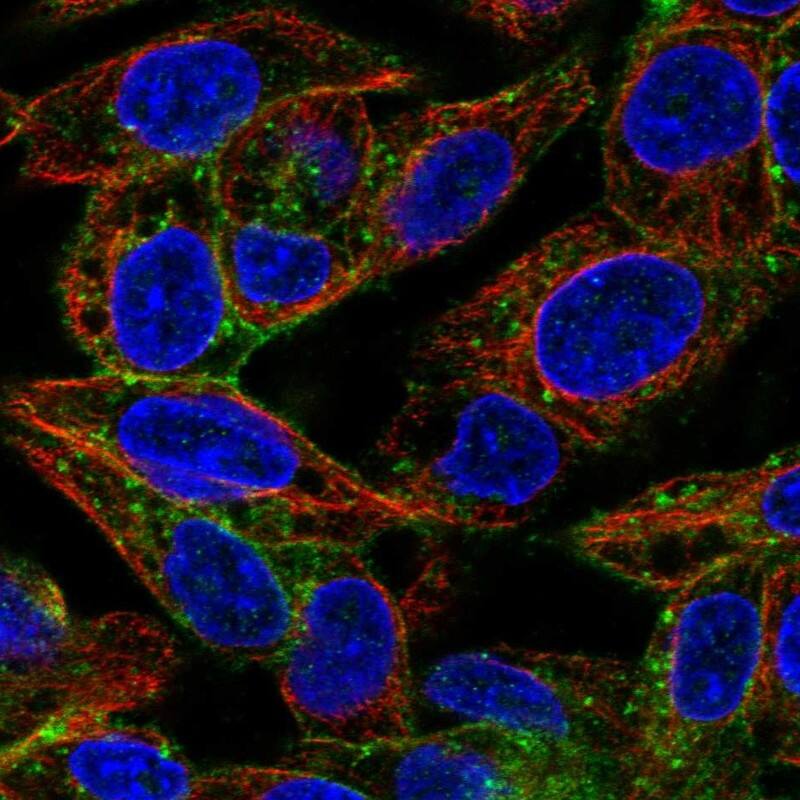 ASGPR1 Antibody - BSA Free Immunocytochemistry/ Immunofluorescence: ASGPR1 Antibody [NBP1-85580]