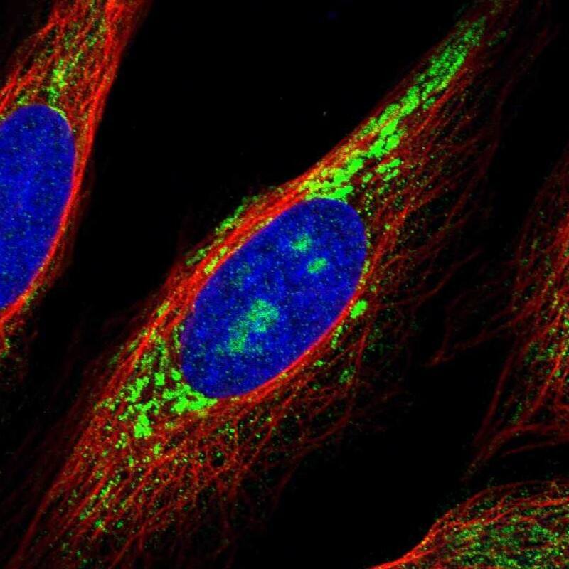 ZNF364 Antibody - BSA Free Immunocytochemistry/ Immunofluorescence: ZNF364 Antibody [NBP1-85586]