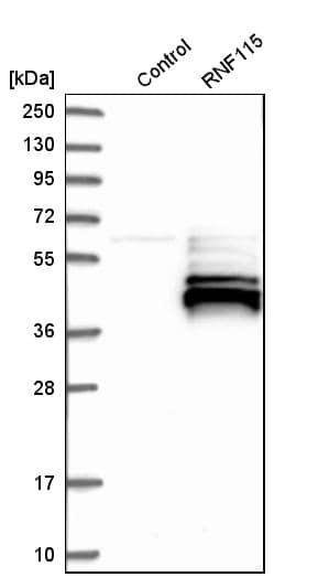 ZNF364 Antibody - BSA Free Western Blot: ZNF364 Antibody - BSA Free [NBP1-85586]