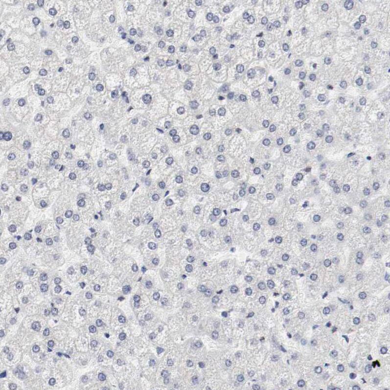 CD117/c-kit Antibody - BSA Free Immunohistochemistry-Paraffin: CD117/c-kit Antibody - BSA Free [NBP1-85593]