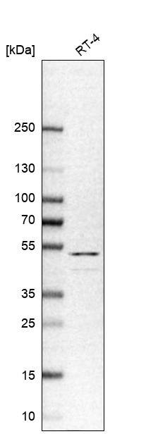 Cytokeratin 20 Antibody - BSA Free Western Blot: Cytokeratin 20 Antibody - BSA Free [NBP1-85598]
