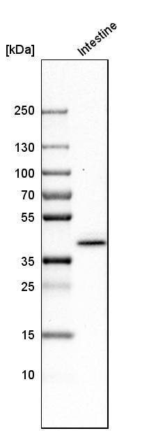 Cytokeratin 20 Antibody - BSA Free Western Blot: Cytokeratin 20 Antibody - BSA Free [NBP1-85599]