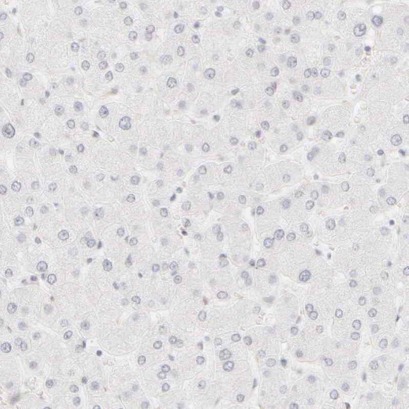 Cytokeratin 15 Antibody - BSA Free Immunohistochemistry-Paraffin: Cytokeratin 15 Antibody - BSA Free [NBP1-85603]