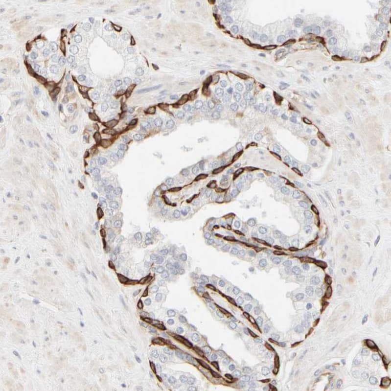 Cytokeratin 15 Antibody - BSA Free Immunohistochemistry-Paraffin: Cytokeratin 15 Antibody - BSA Free [NBP1-85603]