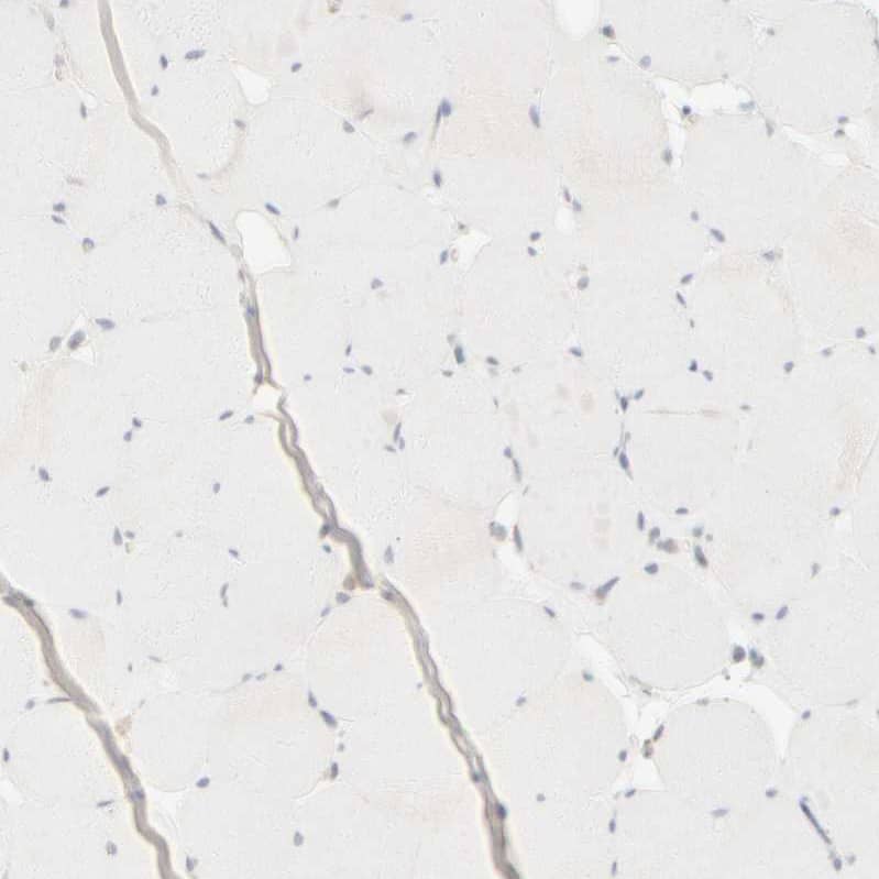 Cytokeratin 15 Antibody - BSA Free Immunohistochemistry-Paraffin: Cytokeratin 15 Antibody - BSA Free [NBP1-85603]