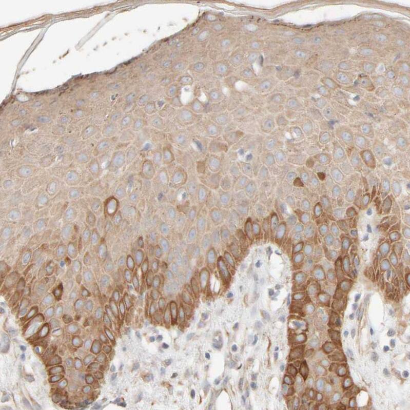 Cytokeratin 15 Antibody - BSA Free Immunohistochemistry-Paraffin: Cytokeratin 15 Antibody - BSA Free [NBP1-85603]