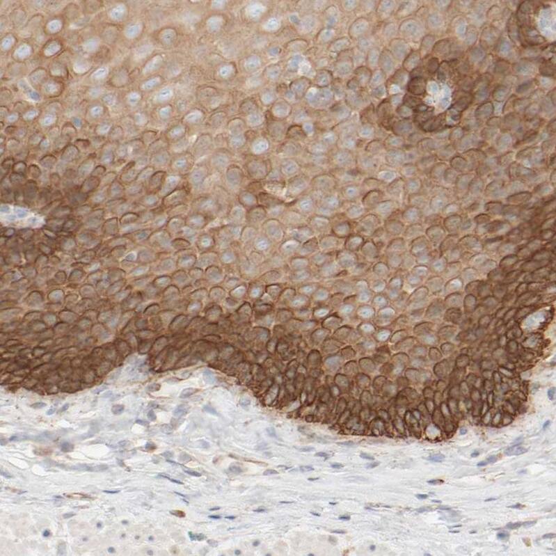 Cytokeratin 15 Antibody - BSA Free Immunohistochemistry-Paraffin: Cytokeratin 15 Antibody - BSA Free [NBP1-85603]