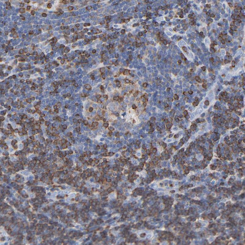 CIN85/SH3KBP1 Antibody - BSA Free Immunohistochemistry-Paraffin: CIN85/SH3KBP1 Antibody - BSA Free [NBP1-85615]
