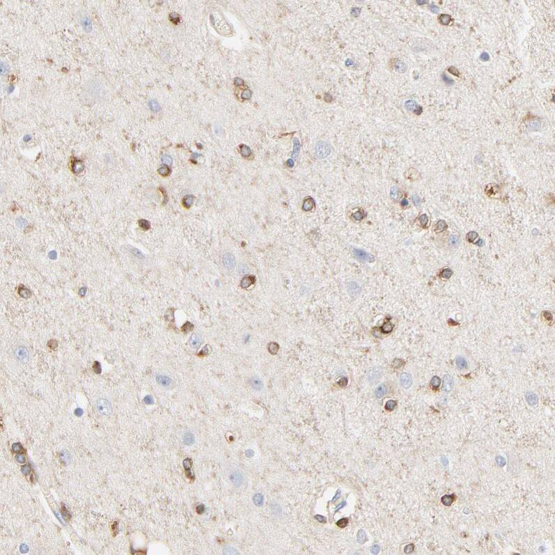 CIN85/SH3KBP1 Antibody - BSA Free Immunohistochemistry-Paraffin: CIN85/SH3KBP1 Antibody - BSA Free [NBP1-85615]