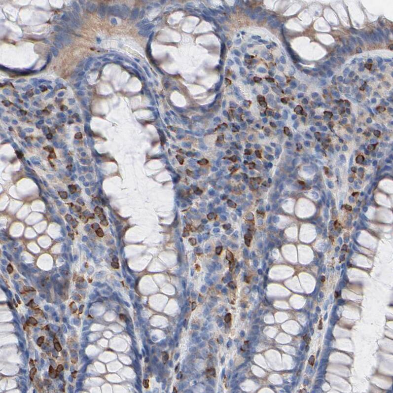CIN85/SH3KBP1 Antibody - BSA Free Immunohistochemistry-Paraffin: CIN85/SH3KBP1 Antibody - BSA Free [NBP1-85615]
