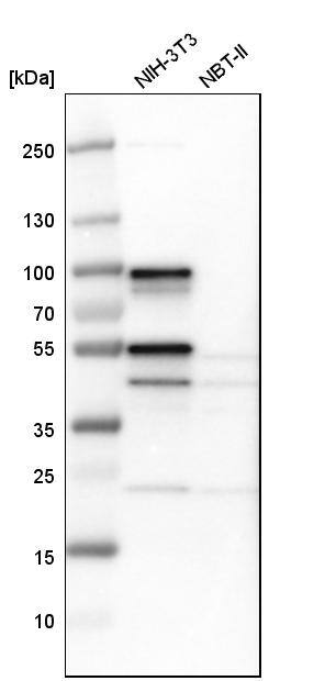 CIN85/SH3KBP1 Antibody - BSA Free Western Blot: CIN85/SH3KBP1 Antibody - BSA Free [NBP1-85615]