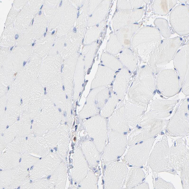 CIN85/SH3KBP1 Antibody - BSA Free Immunohistochemistry-Paraffin: CIN85/SH3KBP1 Antibody - BSA Free [NBP1-85615]