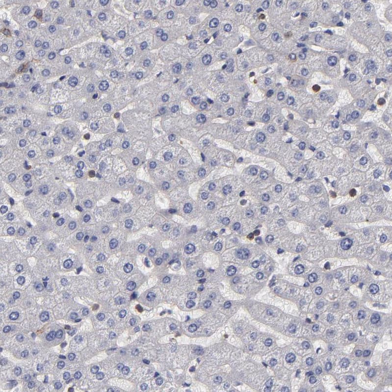 FAM62B Antibody - BSA Free Immunohistochemistry-Paraffin: FAM62B Antibody - BSA Free [NBP1-85627]