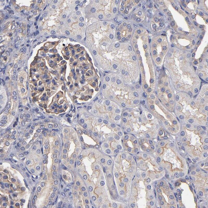 FAM62B Antibody - BSA Free Immunohistochemistry-Paraffin: FAM62B Antibody - BSA Free [NBP1-85627]