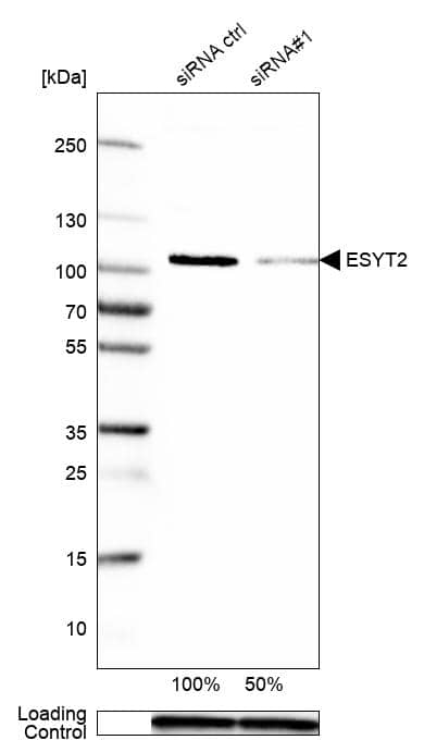 FAM62B Antibody - BSA Free Western Blot: FAM62B Antibody - BSA Free [NBP1-85627]