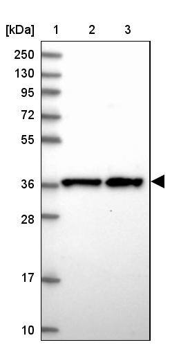 CHORDC1 Antibody - BSA Free Western Blot: CHORDC1 Antibody - BSA Free [NBP1-85629]