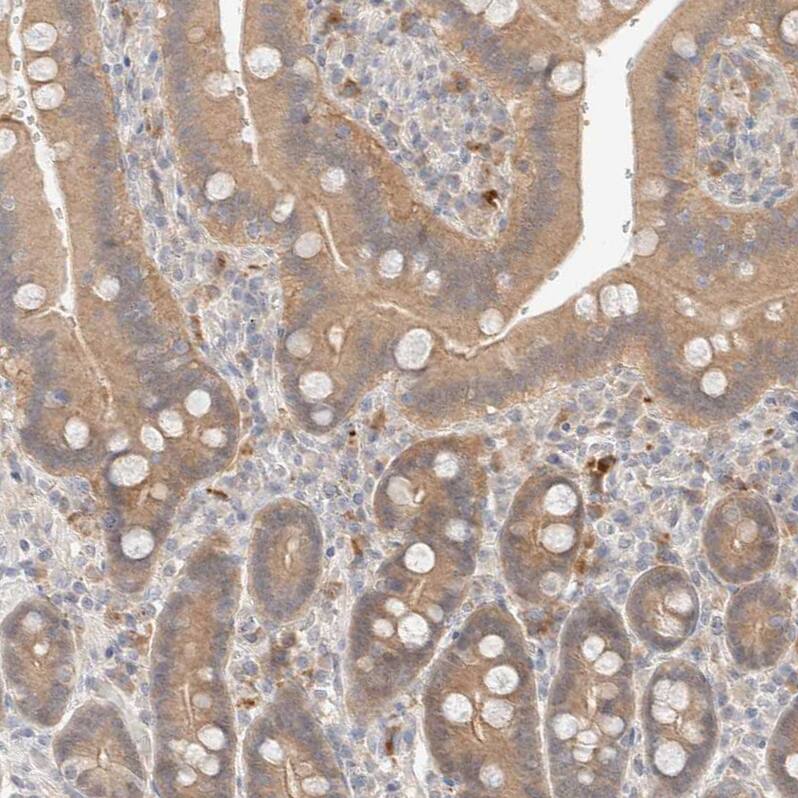 Choline kinase alpha Antibody - BSA Free Immunohistochemistry-Paraffin: Choline kinase alpha Antibody - BSA Free [NBP1-85630]