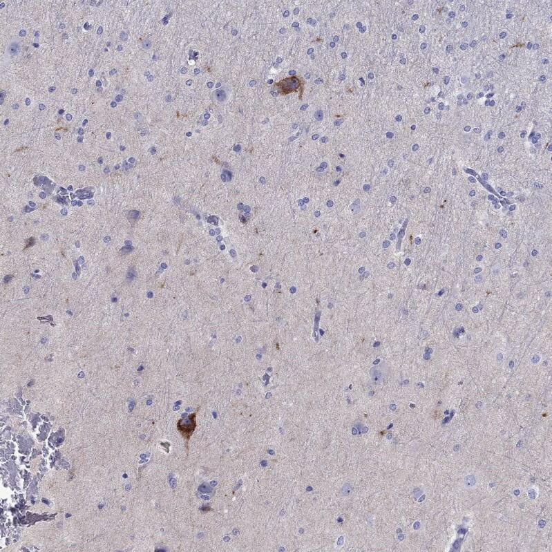 Chromogranin C Antibody - BSA Free Immunohistochemistry-Paraffin: Chromogranin C Antibody - BSA Free [NBP1-85631]