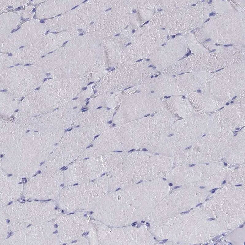Chromogranin C Antibody - BSA Free Immunohistochemistry-Paraffin: Chromogranin C Antibody - BSA Free [NBP1-85631]