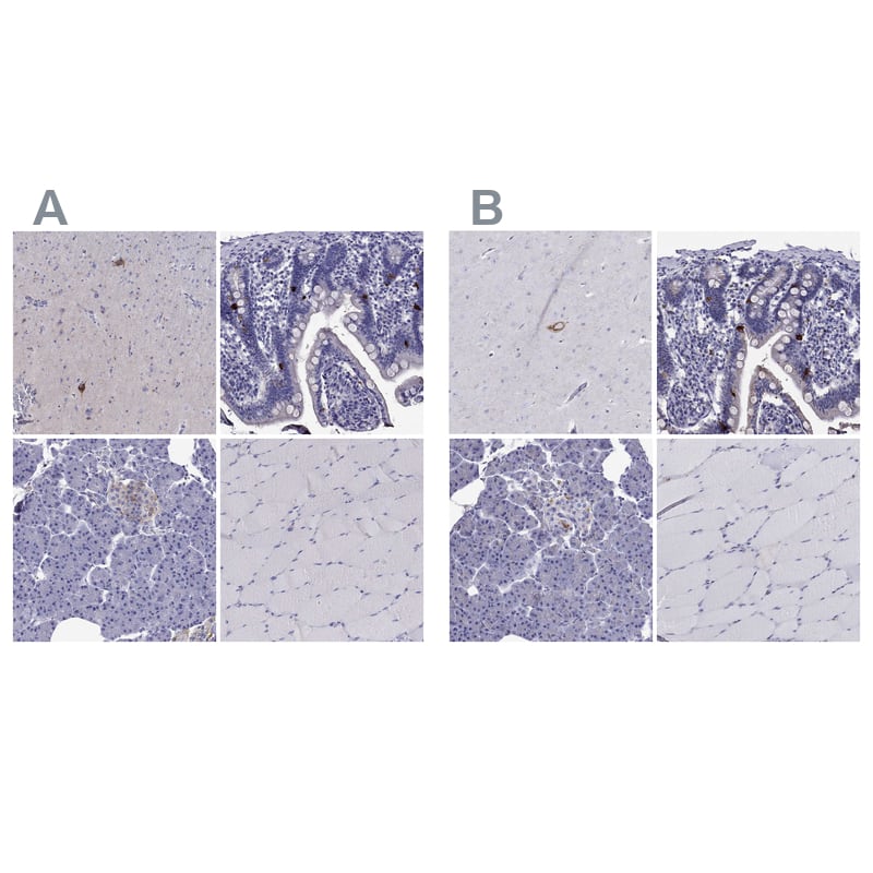 Chromogranin C Antibody - BSA Free Immunohistochemistry-Paraffin: Chromogranin C Antibody - BSA Free [NBP1-85631]