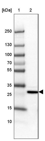 MBNL3 Antibody - BSA Free Western Blot: MBNL3 Antibody - BSA Free [NBP1-85635]