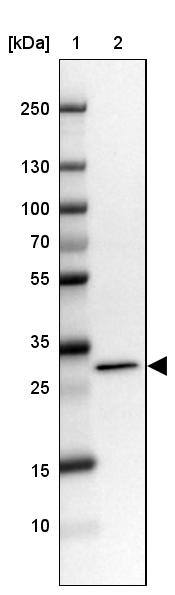 RCBTB2 Antibody - BSA Free Western Blot: RCBTB2 Antibody - BSA Free [NBP1-85636]
