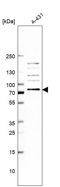Ubiquilin 2 Antibody - BSA Free Western Blot: Ubiquilin 2 Antibody - BSA Free [NBP1-85639]
