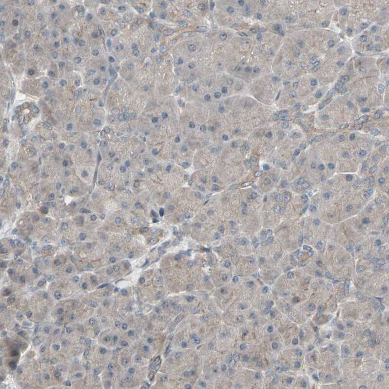 CRLR Antibody - BSA Free Immunohistochemistry-Paraffin: CRLR Antibody - BSA Free [NBP1-85643]