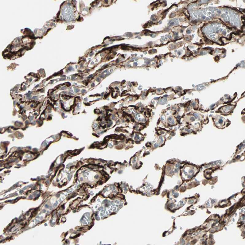 CRLR Antibody - BSA Free Immunohistochemistry-Paraffin: CRLR Antibody - BSA Free [NBP1-85643]
