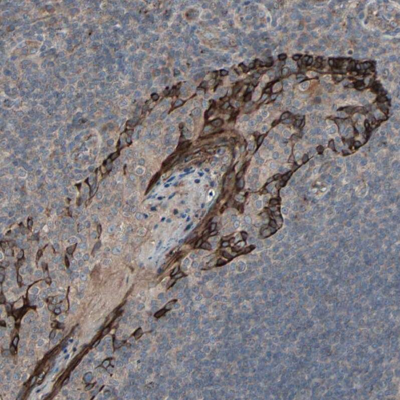 CRLR Antibody - BSA Free Immunohistochemistry-Paraffin: CRLR Antibody - BSA Free [NBP1-85643]