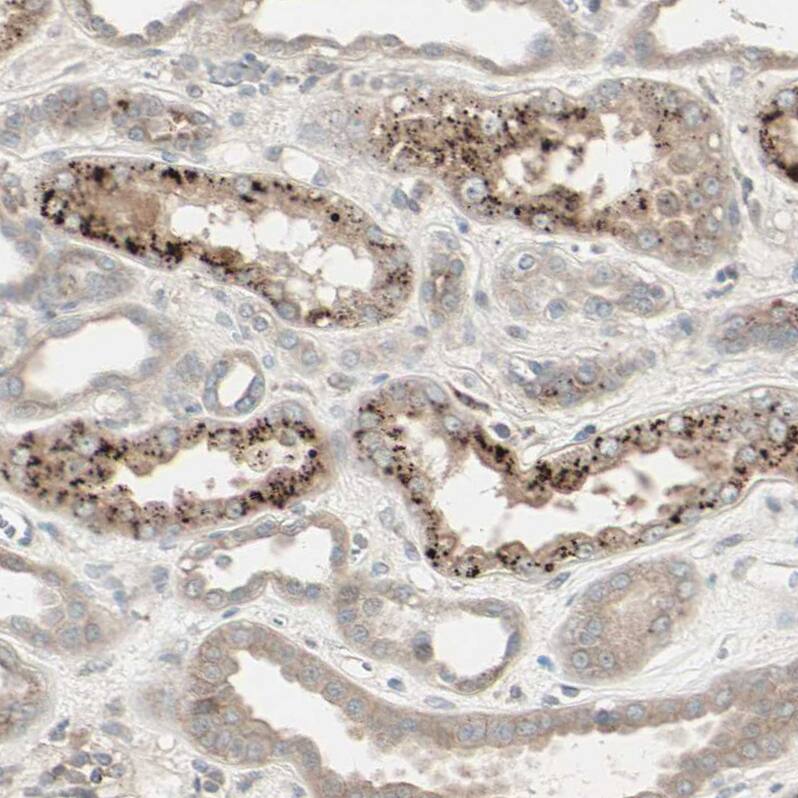 CRLR Antibody - BSA Free Immunohistochemistry-Paraffin: CRLR Antibody - BSA Free [NBP1-85643]