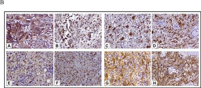 CRLR Antibody - BSA Free