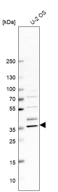 CGR19 Antibody - BSA Free Western Blot: CGR19 Antibody - BSA Free [NBP1-85644]