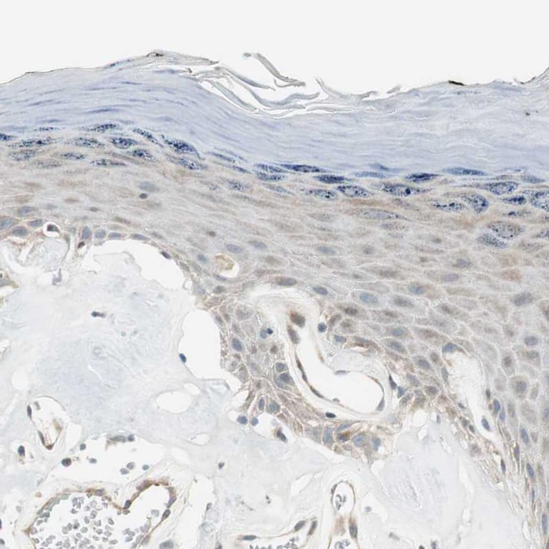 CGR19 Antibody - BSA Free Immunohistochemistry-Paraffin: CGR19 Antibody - BSA Free [NBP1-85644]