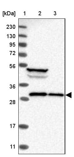 Ribosome maturation protein SBDS Antibody - BSA Free Western Blot: Ribosome maturation protein SBDS Antibody - BSA Free [NBP1-85646]