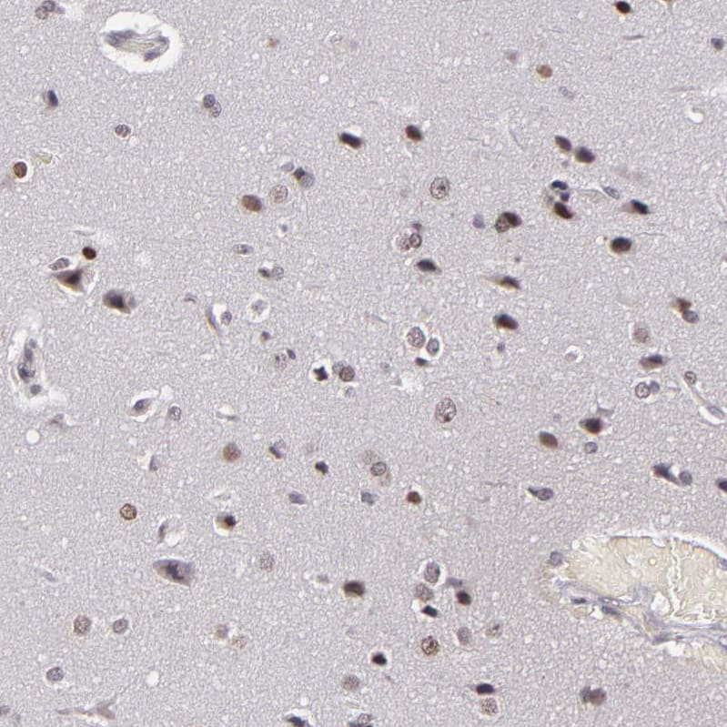 RRP7A Antibody - BSA Free Immunohistochemistry-Paraffin: RRP7A Antibody - BSA Free [NBP1-85647]