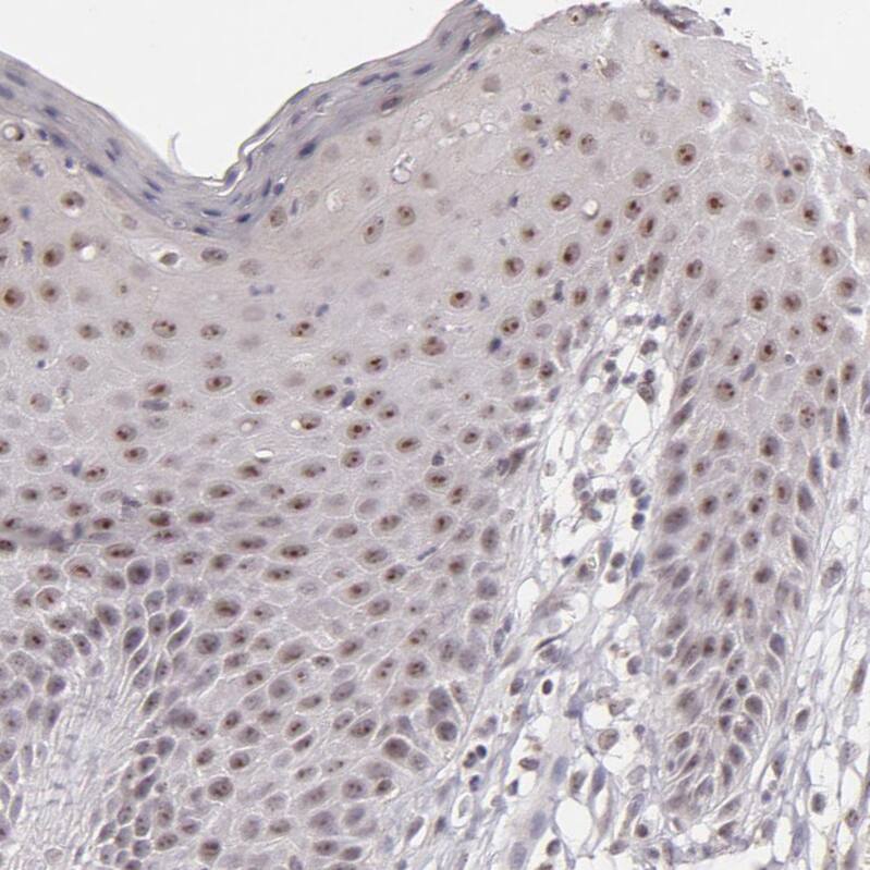 RRP7A Antibody - BSA Free Immunohistochemistry-Paraffin: RRP7A Antibody - BSA Free [NBP1-85647]
