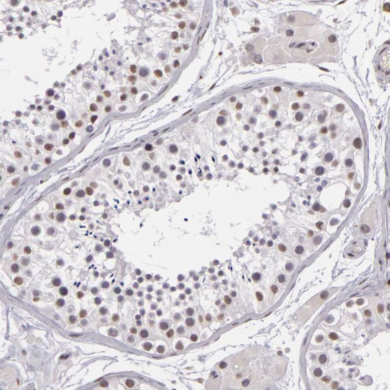 RRP7A Antibody - BSA Free Immunohistochemistry-Paraffin: RRP7A Antibody - BSA Free [NBP1-85647]