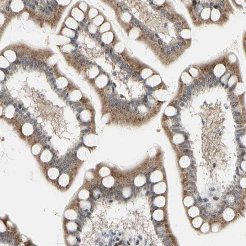 DHRS7B Antibody - BSA Free Immunohistochemistry-Paraffin: DHRS7B Antibody - BSA Free [NBP1-85649]