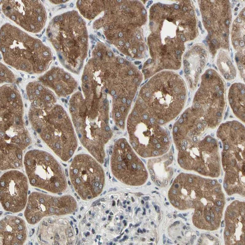 DHRS7B Antibody - BSA Free Immunohistochemistry-Paraffin: DHRS7B Antibody - BSA Free [NBP1-85649]