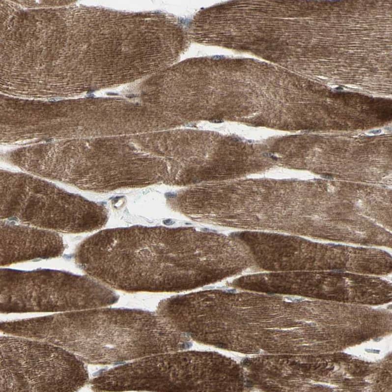 DHRS7B Antibody - BSA Free Immunohistochemistry-Paraffin: DHRS7B Antibody - BSA Free [NBP1-85649]