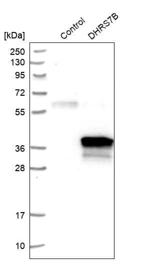 DHRS7B Antibody - BSA Free Western Blot: DHRS7B Antibody - BSA Free [NBP1-85649]