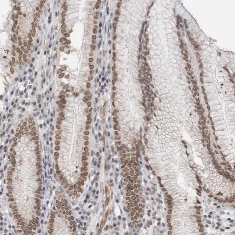 RNA binding motif protein, X-linked 2 Antibody - BSA Free Immunohistochemistry-Paraffin: RNA binding motif protein, X-linked 2 Antibody - BSA Free [NBP1-85650]