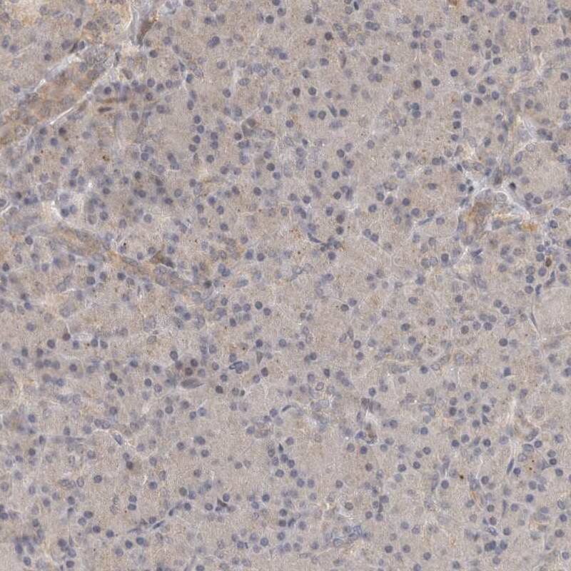 OTUD6B Antibody - BSA Free Immunohistochemistry-Paraffin: OTUD6B Antibody - BSA Free [NBP1-85651]