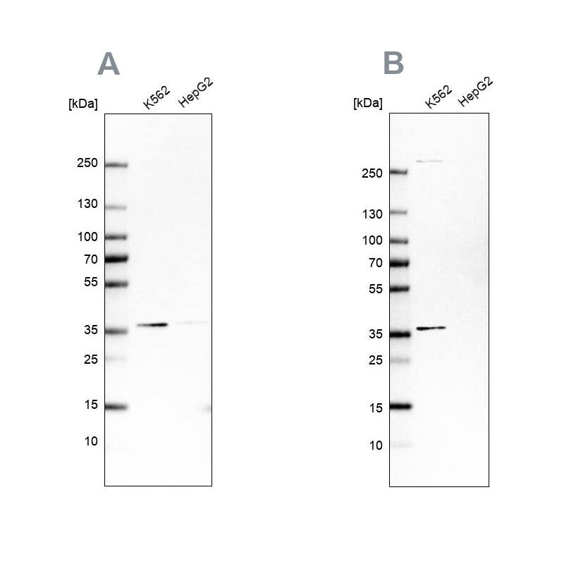 OTUD6B Antibody - BSA Free Western Blot: OTUD6B Antibody - BSA Free [NBP1-85652]