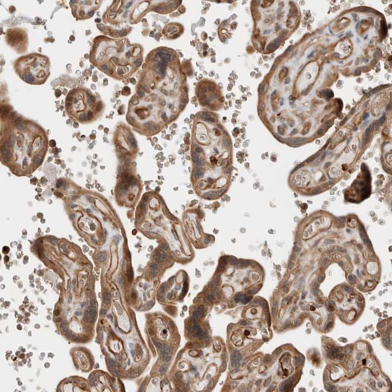 OTUD6B Antibody - BSA Free Immunohistochemistry-Paraffin: OTUD6B Antibody - BSA Free [NBP1-85653]