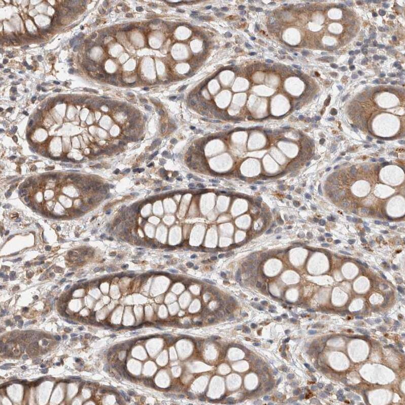 OTUD6B Antibody - BSA Free Immunohistochemistry-Paraffin: OTUD6B Antibody - BSA Free [NBP1-85653]