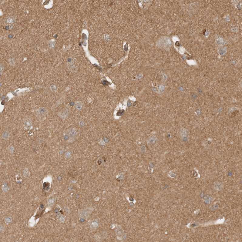 OTUD6B Antibody - BSA Free Immunohistochemistry-Paraffin: OTUD6B Antibody - BSA Free [NBP1-85653]