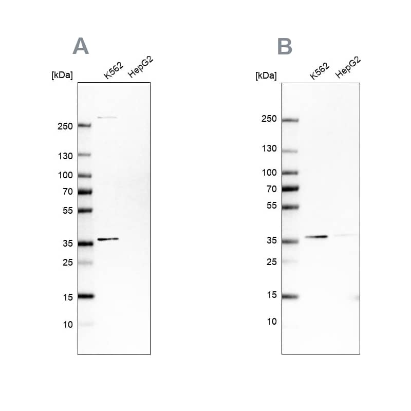 OTUD6B Antibody - BSA Free Western Blot: OTUD6B Antibody - BSA Free [NBP1-85653]